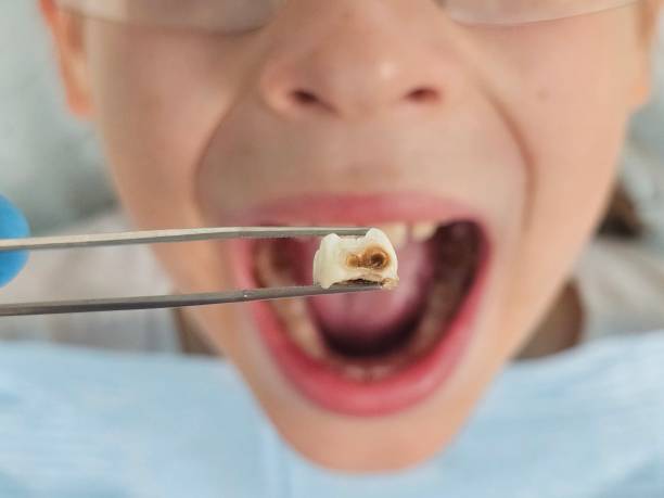 Best Pediatric Emergency Dentist in Petersburg, AK